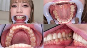 Misuzu - Watching Inside mouth of Japanese cute girl bite-198-1 - 1080p
