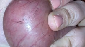 Your balls are popping, that’s for sure !