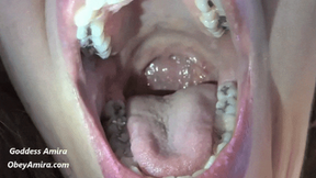 Wide Open Mouth