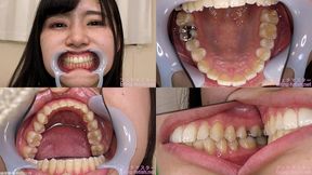 Maya - Watching Inside mouth of Japanese cute girl bite-252-1 - 1080p