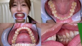 Ayame Nogi - Watching Inside mouth of Japanese cute girl - MOV 1080p