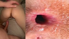 Stepdaughter's stinky ass&#x1F351; booty kiss claims dad's fortune