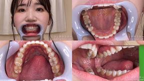 Ayaka - Watching Inside mouth of Japanese cute girl bite-243-1 - wmv 1080p