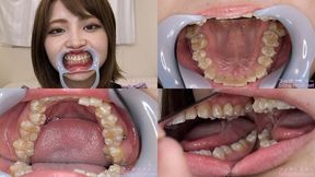 Rui - Watching Inside mouth of Japanese cute girl bite-213-1 - wmv