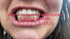 Mouth Tour after first DENTAL CLEANING IN YEARS & NEW FILING