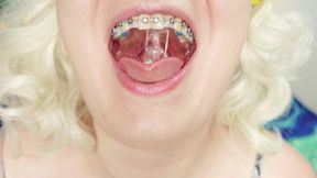 food fetish asmr video in braces! (arya grander)