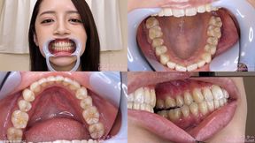 Kanna - Watching Inside mouth of Japanese cute girl bite-242-1 - 1080p