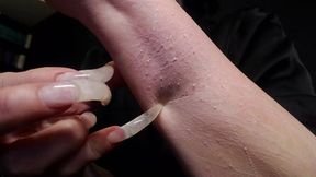 scratching tests clear april 2025