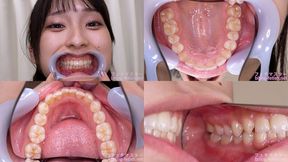 Mino ri Mashiro - Watching Inside mouth of Japanese cute girl