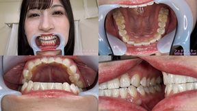 Reira - Watching Inside mouth of Japanese cute girl bite-210-1 - wmv