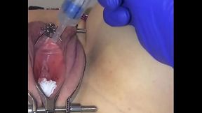 Learn to Insert a Catheter for Women like a Pro!