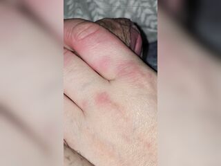 Step mamma hand has allergy on step son shlong during the time that tugjob