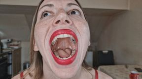 After the dental appointment