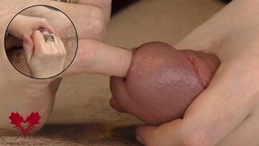 tender sounding - super close-up of urethral penetration