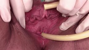 catheter and surgical gloves (1080 wmv)