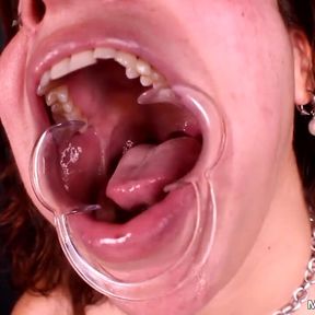 Inside my mouth: ginary