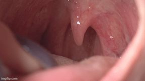 swollen throat