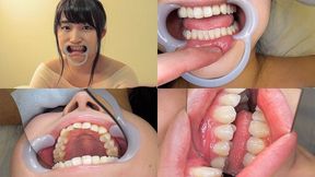 Yuri - Watching Inside mouth of Japanese enchanting girl BITE-47-1 - wmv 1080p