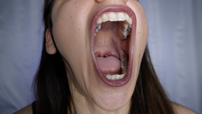 Wide Open Mouth Fetish