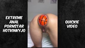 Jan 3, 2024 Deep Anal&#x1F44C; Frenzy, Giant Prostate, Juicy Butt&#x1F351;, Sizzling Pussy&#x270C;