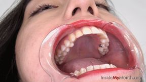 Inside My Mouth - Hana - Mouth retractor clip (4K quality)