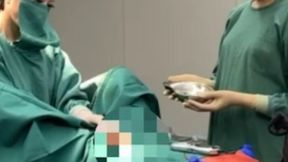 Patient getting a hand job by two doctors in the operating room