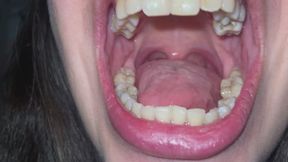 flashlight on uvula, teeth, tongue and throat