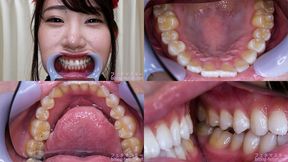 Kiyoka Igarashi - Watching Inside mouth of Japanese cute girl - 1080p