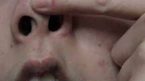 Aurora's Nose-Picking Drives You Wild