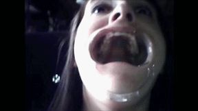 Endoscopy on a date wmv