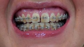 Face And Mouth HD-480