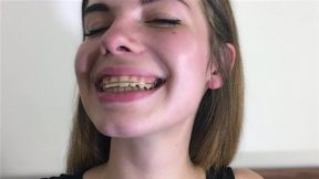 Klara’s Braces For First Time - HD 1920x1080