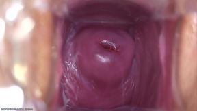 Lola Myluv - Cervix With A Smile