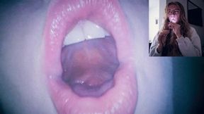 Endoscope in my mouth - burping mp4 FULL HD
