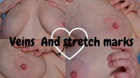 Stretch marks and veins on my natural tits