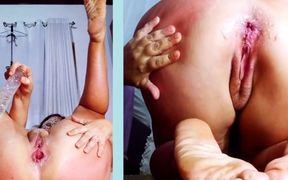 Opening Her Ass Showing Her Broken Ass