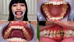 Meru Adachi - Watching Inside mouth of Japanese cute girl - MOV