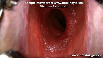 Scraping the depths of forbidden desire, 'HKJ' succumbs to unbridled rectal ravagement by gargantuan speculum & monstrous dildo