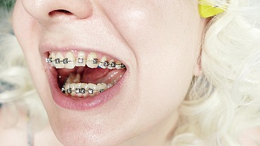 food fetish ASMR video in BRACES (Arya Grander)