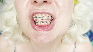 food fetish ASMR video in BRACES (Arya Grander)