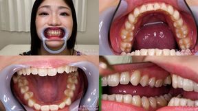 Yuina Taki - Watching Inside mouth of Japanese cute girl - MOV 1080p