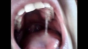 Endoscopy yawning