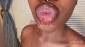 100 Kisses