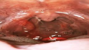 Eating gummies with sparkling water - Experience Vore uvula wide open 720HD