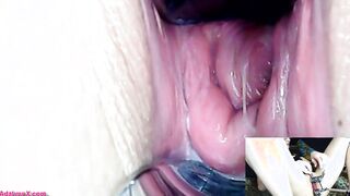 AdalynnX - Endoscope Speculum Hitachi Dildo Cum