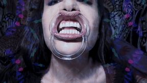 Mouth expander, teeth and lips showing loop