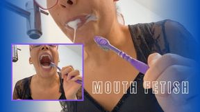 Dirty Teeth