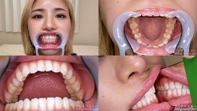 Riria Hyodo - Watching Inside mouth of Japanese cute girl