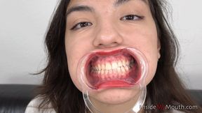Inside My Mouth - Hana - Mouth retractor clip (FULLHD quality)