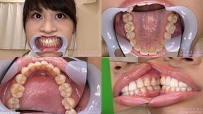 Shiori - Watching Inside mouth of Japanese cute girl bite-241-1 - wmv